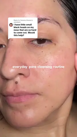 Replying to @Yesenia Alvarez You asked if it helps with blackheads… here’s how I use my 3-step Centella kit. It keeps my skin balanced and pores looking clear. @SKIN1004 US 