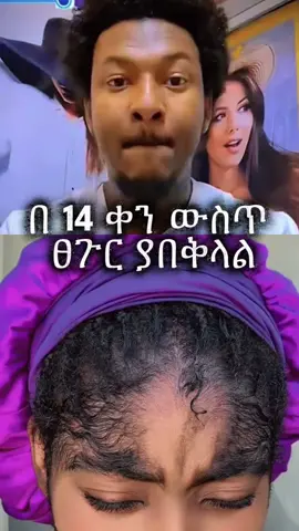 alecrim_rosmary_oil #ኢትዮጵያ_ለዘለዓለም_ትኑር🇪🇹🇪🇹🇪🇹  #habeshatiktok #fyp