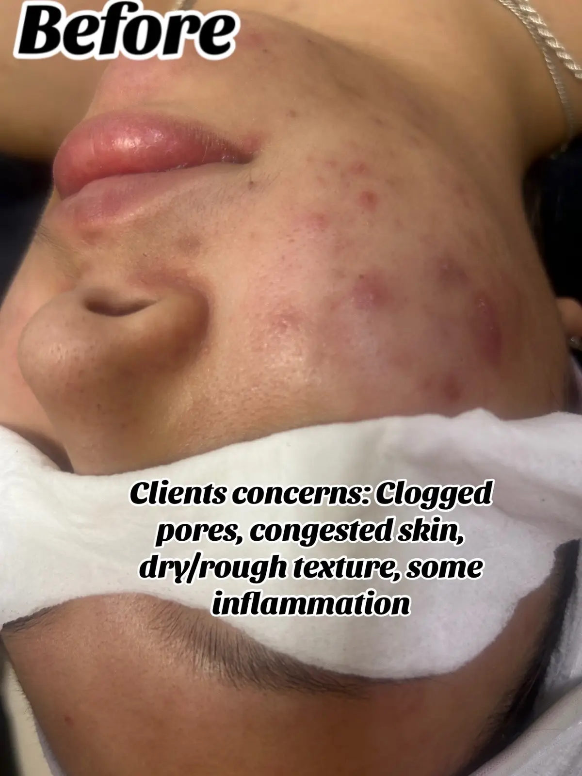 🌟 Everyone can benefit from a good exfoliation and a good enzyme!  I recommend this deep cleansing facial once a month for maintenance 🌟 *All of my facials include a amazing facial, neck & décolleté massage 💆🏻‍♀️ Most clients fall asleep during this part and never want me to stop so I added a extended facial option which allows more time for massage OR extractions.. which ever you prefer to focus on.  📍 Located in Vegas Rhodes Ranch Town center Call/Text 1 (702) 972-6026  7415 s durango dr 