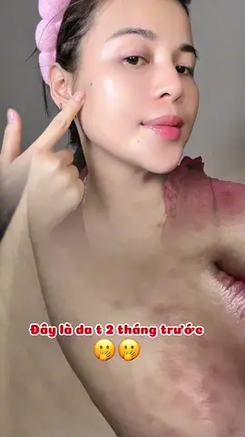 Bà nào da dầu mụn thì có thể cân nhắc em này nha  #kemduongam #xuhuong #garnier #goclamdep