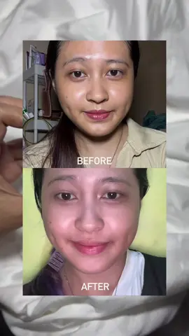 Moist retinol terbaik! 😍✨ #LANBENA #Lanbenaskincare #lanbenaretinol #skincareroutine @Lanbena.Indonesia 