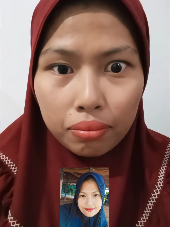 hanya berselang 7 bln semua berubah.  #autoimun #myastheniagravis #ikhlas 