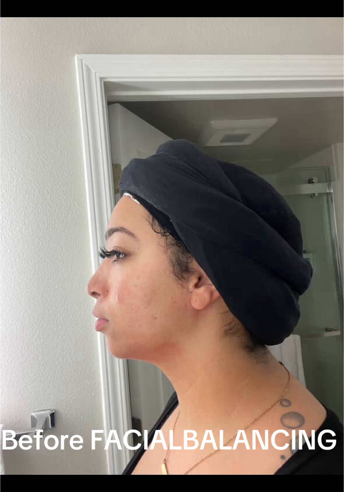 WOW 😍 THE 5ML GLOW will do it everytime ✨🧚🏽 JAWLINE  , CHEEKS ,RUSSIAN LIPS , NON SURGICAL NOSE LIFT , CHIN 💕✨ (this client has had two sessions within a 8 months )  SEPTEMBER IS FULLY BOOKED ! October books open this week 🧚🏽 dm to book your consultation✨ #russianlips #fyp #viral #atlanta #atlfacialbalancing #facialbalancing #beforeandafter #GlowUp #lipfiller #jawline #elpepe 
