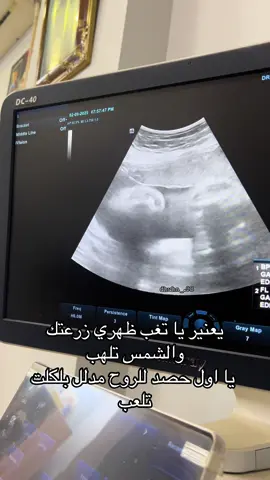 يا من انتظرتهُ11 سنة يا هلا بجيتك 🫀🫂#اللهم_احفظه_بعينك_التي_لا_تنام #اللهم_صلي_على_نبينا_محمد #الشعب_الصيني_ماله_حل😂😂 #foryoupage #مالي_خلق_احط_هاشتاقات 