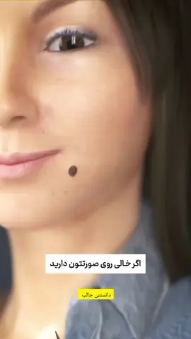 #مهم #خال #صورت#درد #بابرش 