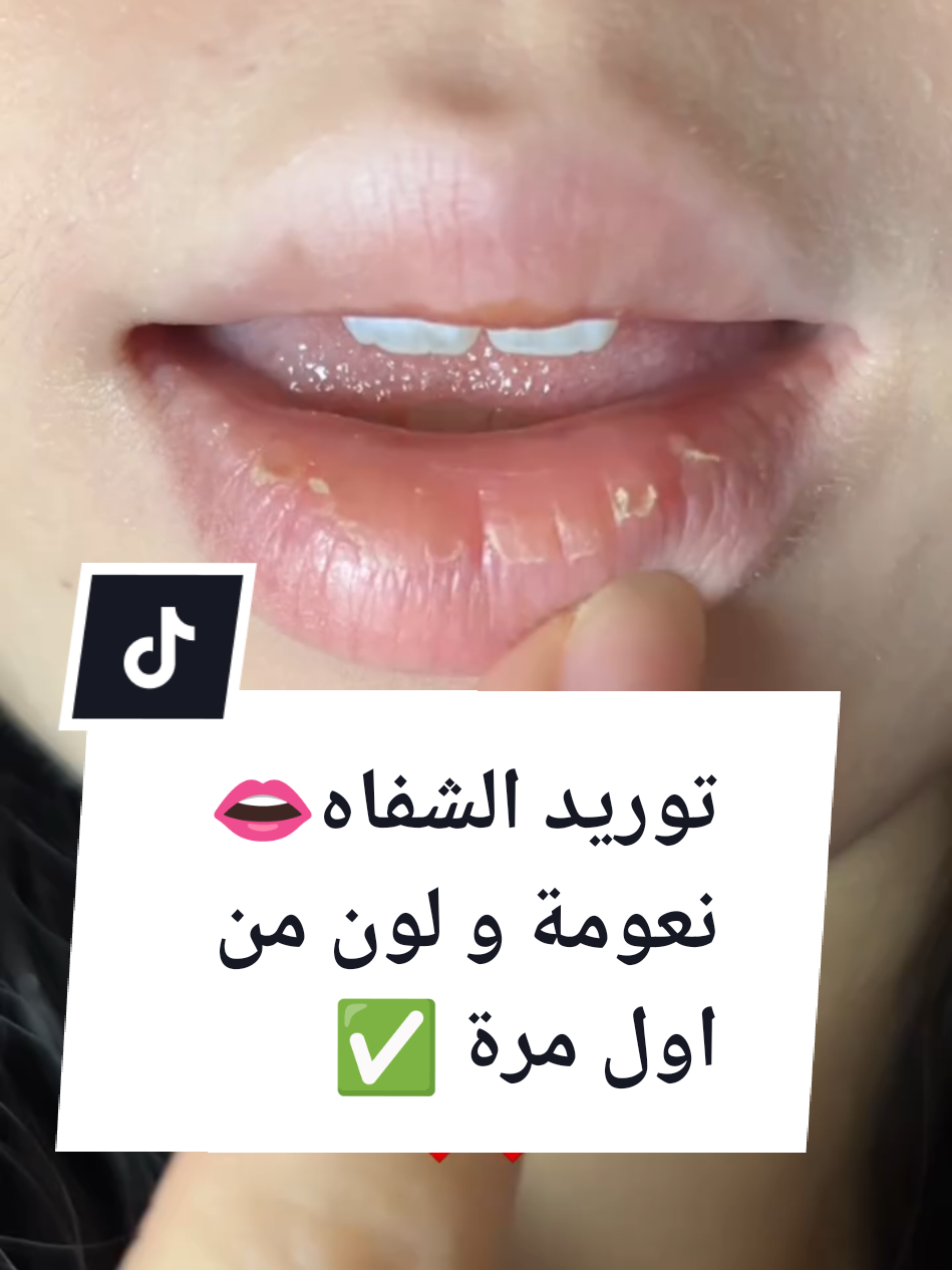 لما يسألني زوجي كيف شفايفك وردية و انت ماتحطين روج👄💄🌸 #توريد_شفايف😘 #نفخ_شفايف #تقشير_الشفاه #fyp #اكسبلور 