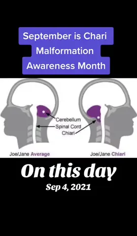 #onthisday 