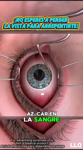 ¿Vista borrosa con la edad? Aquí está la razón (y la solución)#SaludVisual #Antioxidantes #VisiónClara #OjosJóvenes #RemedioNatural #CansancioVisual #SinAzúcar#dealsforyoudays