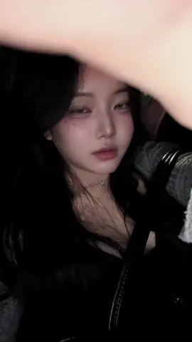 붓기언제다빠지냐 #ㅊㅊ #06 #추천
