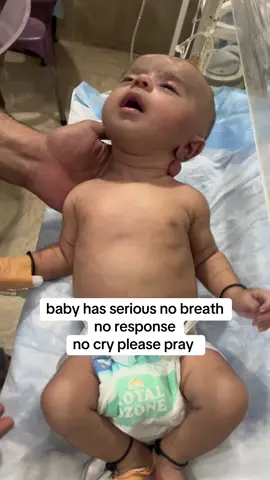 baby has hold breathe no response #newbornbaby #unfreezemyacount 