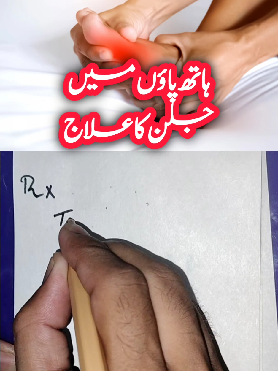 Treatment for burning sensation in hands and feet 🐾 #burning #hands #feet #foryou #medicine 