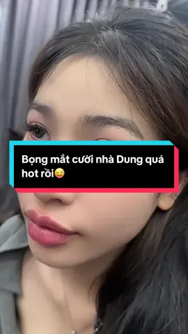 Bọng mắt cười nhà Dung quá hót dồi cả nhà iu ơi #fillers💉 #filler_boxtox #filler_boxtox #cân_chỉnh_mặt_fullface #cấy_ha 