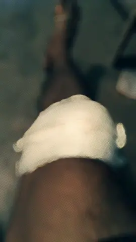 Bike Accident🏍️😞 #fpyyyyyyyyyyyyyyyyyyyyy #bagladesh🇧🇩tiktok #fouryou #viralvideo #fpyyyyyyy 