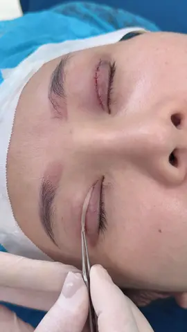 Ở đây có mí đẹp #cắtminideep #thammytunhien #sửamí 