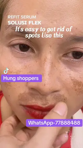 Skin care set by Hung shoppers #creatorsearchinsights #fy #foryoupage❤️❤️ #fypシ゚viral🖤tiktok #foryoupageofficiall @Tara-closet🛍️ @Pema Jigme Norbu @Kin Wong🇧🇹 @Hung Htt @🌲JIMCHON(MINDU) @Kelzang Dechen @PemaDeki @yesheymoon @🎸Melody🎶 Star 🌟 @🇧🇹pema-4 @🌍Babydrukpala🌎 @🐉🐉 TENZING D-R-A-G-O-N 🐉🐉 @💕👧Tuksi_&👶Bubu’s_MAMA👩🏻💕 @Apple🍎zangmo🍎 @Dechen Pelden 🇧🇹 @Karma@55 @Tshogyel1995 @Eudruma 🧿 @Etsu @Life is Beautiful @Stacy DruKpa🇧🇹 @🫵YOUR MEDICINE 💊💊💊 @𝙎𝙖𝙣𝙜𝙖𝙮 𝙎𝘿 @Gem Gyeltshen @Humble man🙏🙏🙏 @Tenzin Dolma @Norlha🩵Tshelha✨ @Phubzam Bhutan 