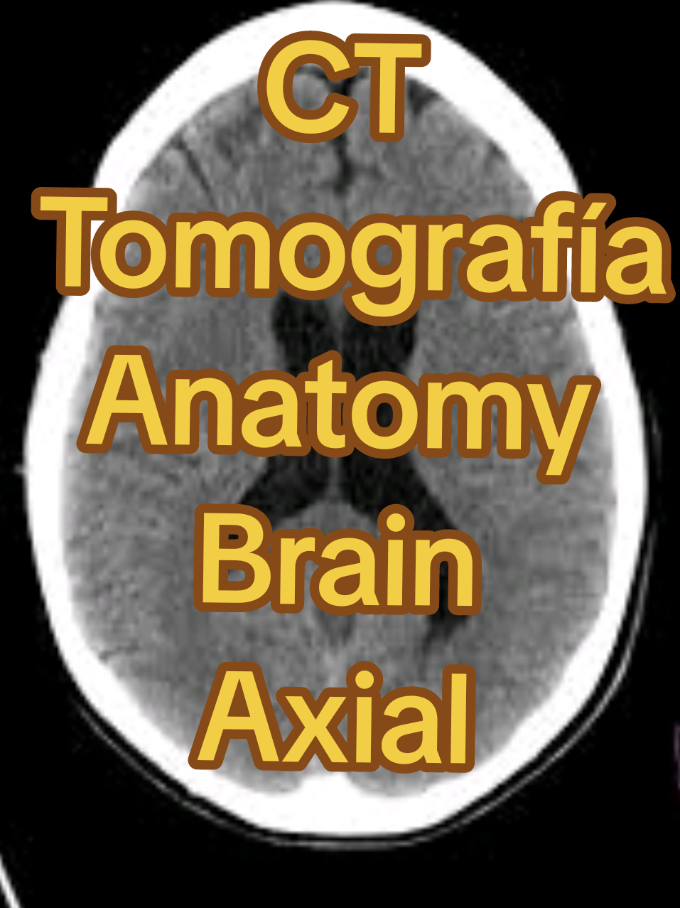 CT BRAIN ANATOMY🧠 tomografía #creatorsearchinsights #tomografia #scanner  #اشعه #xray 