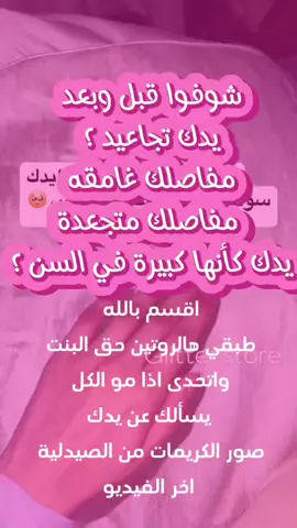 #اليد #اليدين_تفتيح #اليدين_الناعمتين #تجاعيد #تجاعيد_اليد #تجاعيد_اليدين #مفاصل_اليدين #مفاصل_اليد 