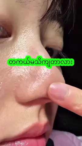 #အမှန်တကယ်ပျောက်ချင်မှလာဝယ်ပါ100%အာမခံ#ငွေပြန်အမ်းမယ်ထိအာမခံချက်အပြည့် #အိမ်ရောက်ငွေချေနဲ့ပို့ပေးပါတယ် #ပန်းသီးစိမ်းမျက်နှာသစ်ဆပ်ပြာ🍏🍏🍏 #တကယ်ပျောက်ချင်ချင်မှသုံး 