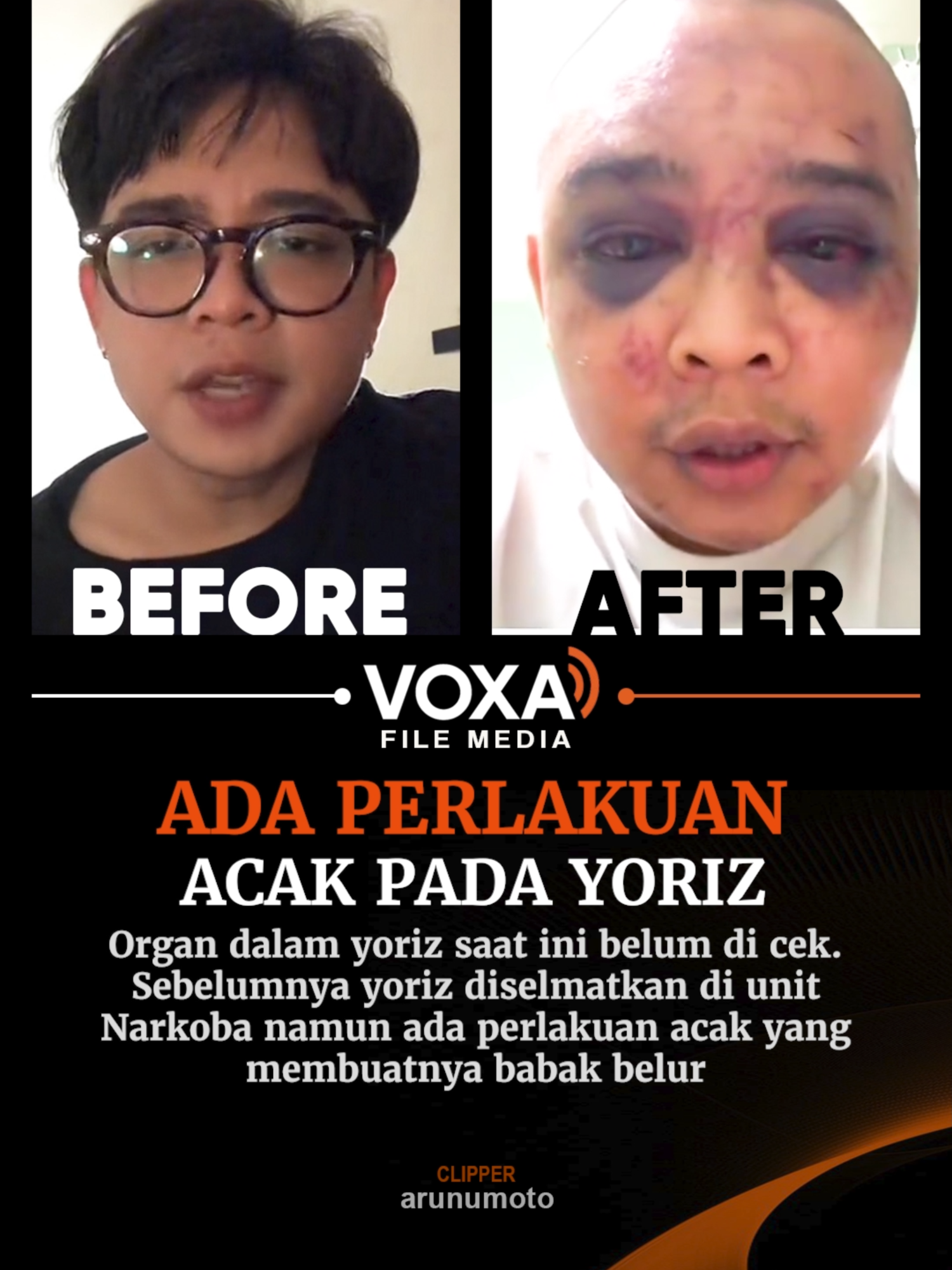 Karena ada perlakuan acak dari pihak titik titik sampai membuat yoriz babak belur