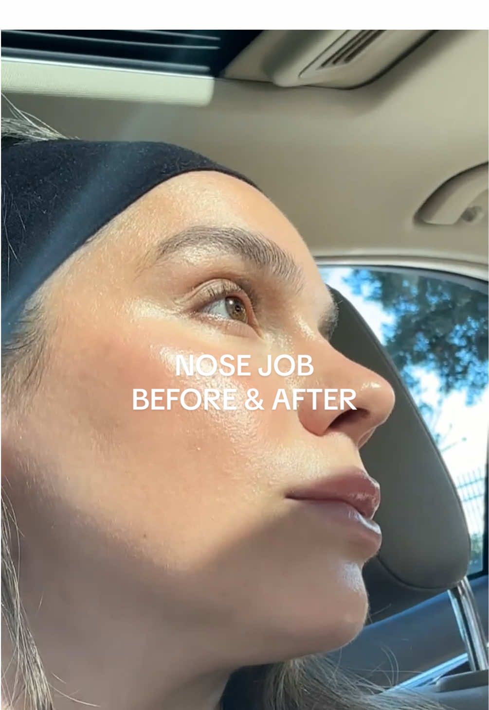 👃🏼✨🇹🇷🧿 