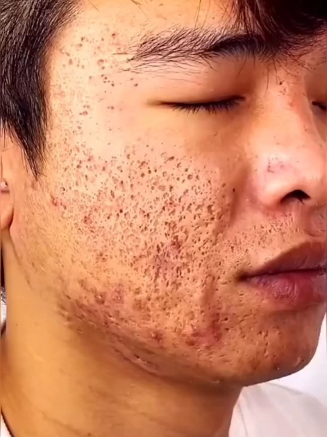 #GreenMaskStick #ThéVertSkincare #PoreCleansing #TikTokShop #BeautyHack #SkincareASMR