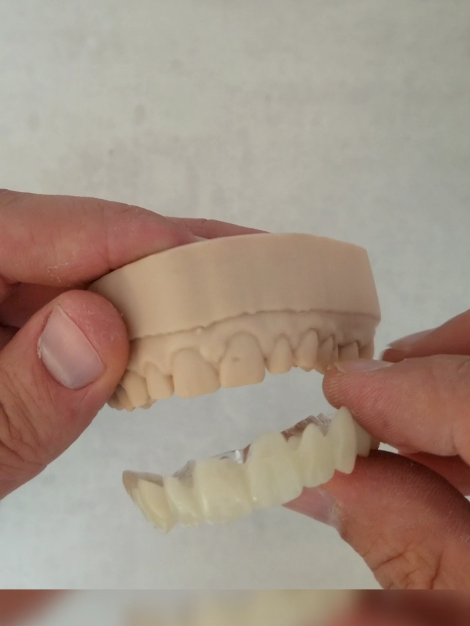 CMD   . . . . . . . . . #Modellguss #zahntechnik #zahntechniker #dentist #dental #