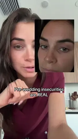 I wish I had found this MONTHS ago😭 I can’t imagine what the results will be after using it for a while! Dr melaxin again with an amazing product 🙌🏼 #drmelaxin #koreanskincare #wrinkles #darkspots #wedding @Dr.Melaxin Global  Dr Melaxin Collagen Calcium balm stick for fine lines, deep set smile lines, hollow under eyes, dark spots, brightening and smoothing!! 