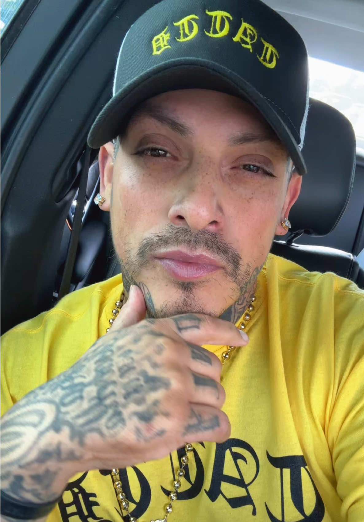 Update on my emergency surgery!!! 🚨 #tattdg #tattd #tatted #tattoos #mexican 