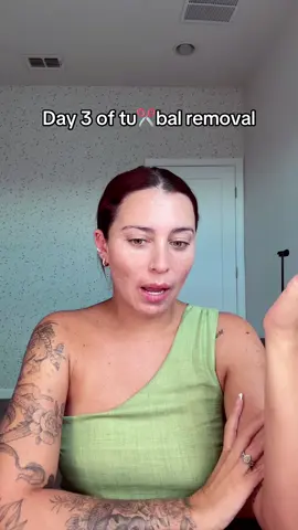 90% back to normal at only 3 days of my #laparoscopía 😌 #snipsnip #relatablemomcontent #tuballigation  #orlandoinfluencer 