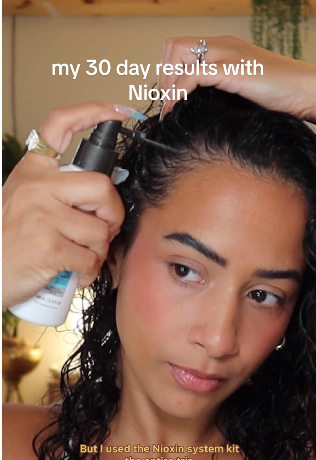 my 30 day results using the @Nioxin system kits☺️ my hair is feeling thicker, stronger and I even had new growth in a bald spot.  I’m impressed that I was able to see results even after having a protective style in, and being in salt water while on vacation. If you’re looking to protect and strengthen your hair try the Nioxin system kits! #nioxinpartner #healthyhair #hairjourney #hairgrowth 