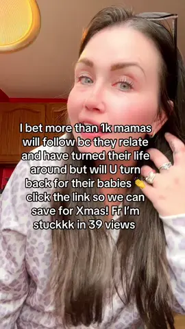 🥱 free shipping nobody’s ripping ya hair out gf I got u click n add to cart hehe #tts #recovery #relatable #motherhood 