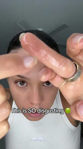 For all my pimple poppers out there 😭 #acne #breakouts #nlackheads #whiteheads #cloggedpores #beplain #doublecleansing #clearskin #koreanskincare #oilyskin #combinationskin #oilyskincare #skincare #beauty #BeautyReview #tiktokshopcreatorpicks #skindetox 