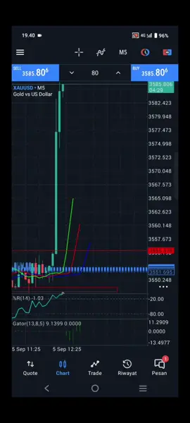 #tranding #traderxauusd #forex #fyp 