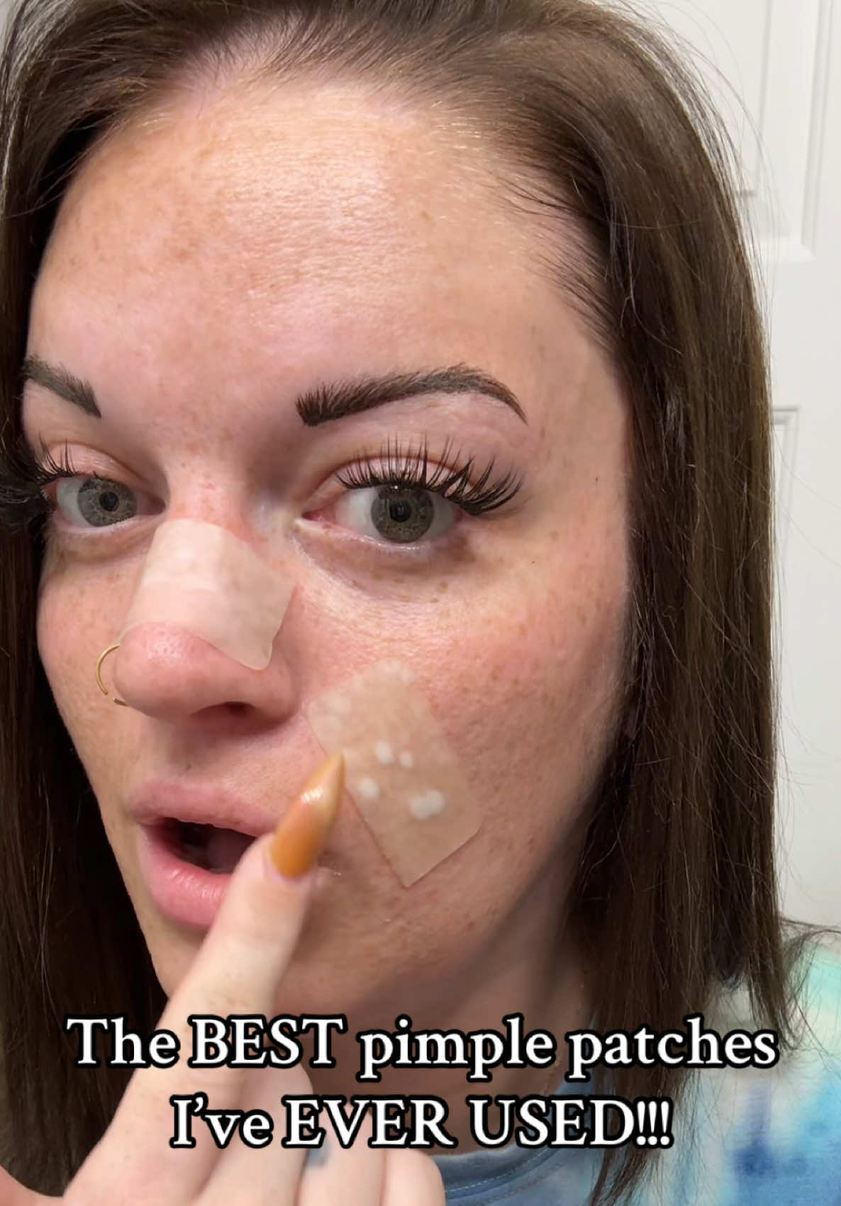I’m amazed every. single. time!!! #pimplepatch #skincareroutine #xyzbca 