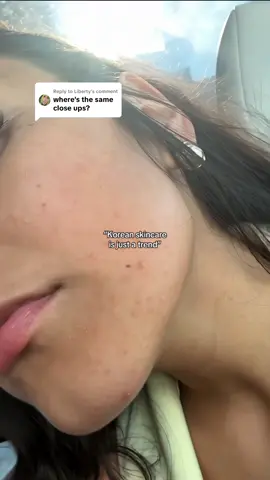 Replying to @Liberty if you want more proof Korean skincare WORKS, here it is ❤️ #acne #koreanskincare #skintransformation #glassskin #tiktokshopcreatorpicks 