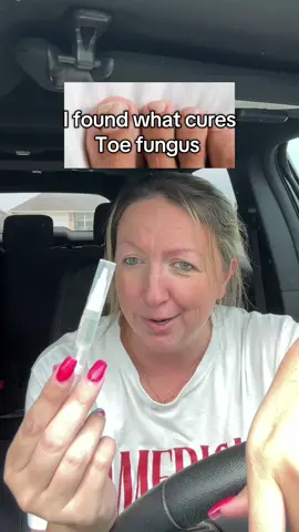 Leave that toe fungus in the past! #lunavia #toefungus #fungus #lunaviaantifungalpen #antifungal @mylunavia 