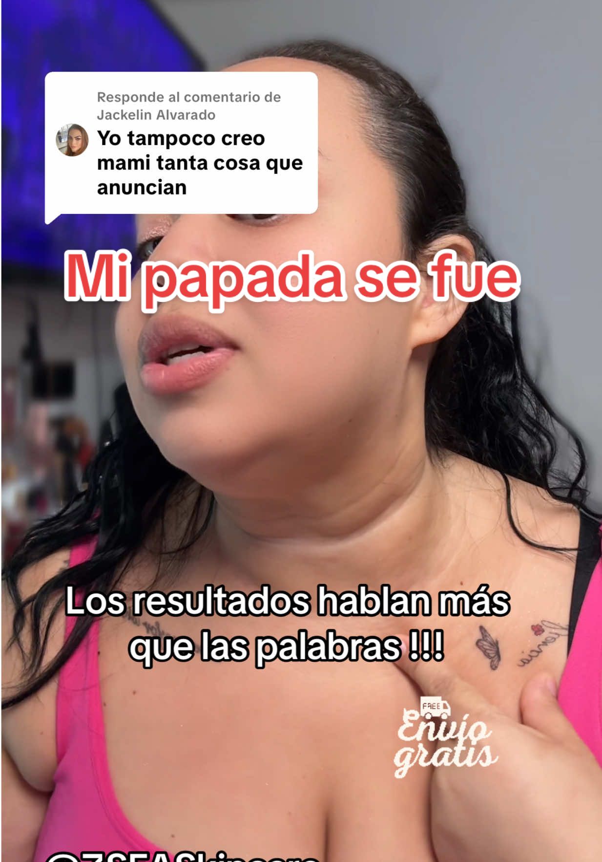 Respuesta a @Jackelin Alvarado si quieres ver más resultados déjame saber y te vuelvo a subir mi  progreso  corazón 🫶🏻 #tiktokshopcreatorpicks #tiktokshopblackfriday #tiktokshopchristmas #neckmassager #neckfirmingcream 