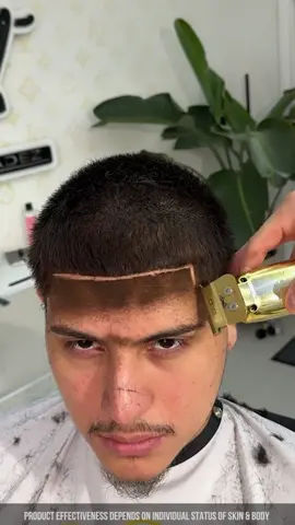FEG Plus hair gro.wth serum - Buy one get one free, link in bio #fegplus #hairserum