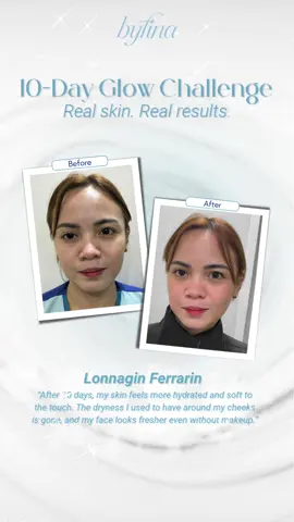 10-days glow unlocked! Freshness? ✅ Brightness? ✅ Smoothness? ✅ Glass skin mode ON! 🪞✨ Shop link: TikTok: https://vt.tiktok.com/ZSBn2nKq1/?page=TikTokShop @Loisa Andalio  #Byfina #finay #LoisaAndalio #Skincare #10Dayschallenge
