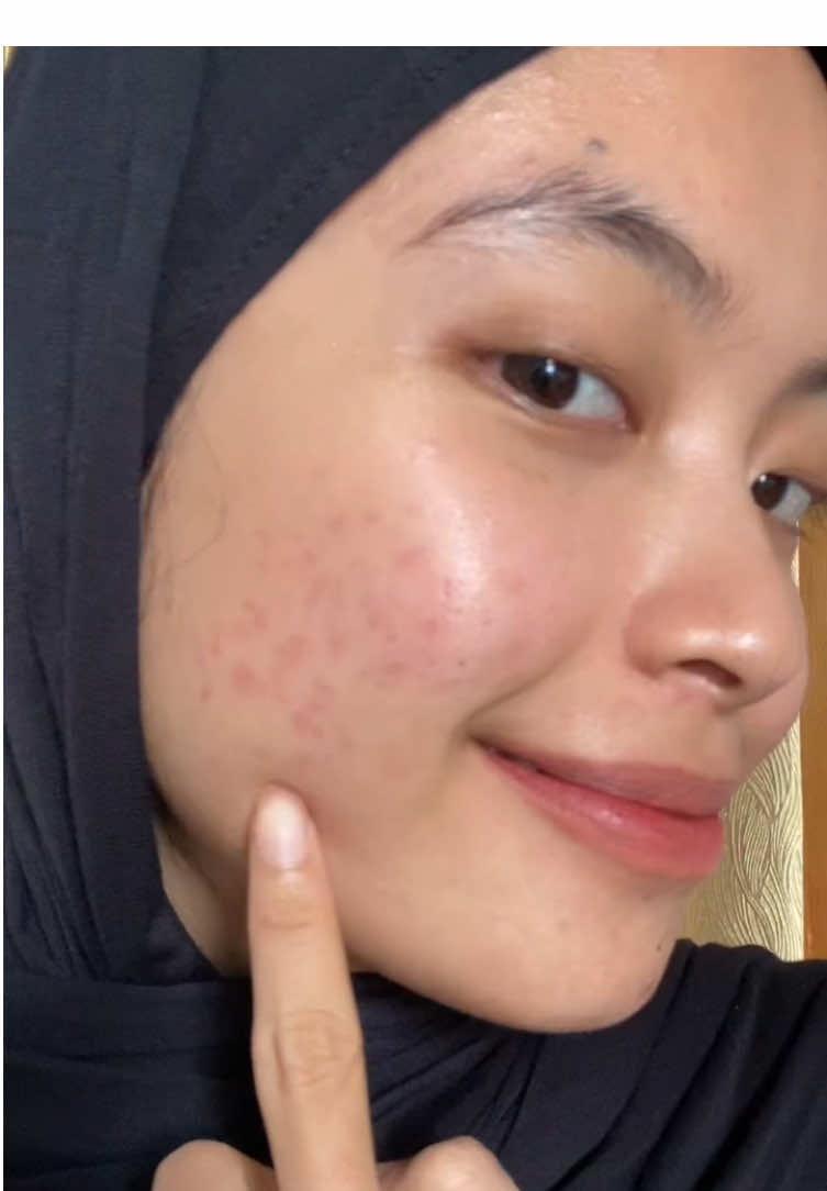 gacor banget serum @RELUVIE OFFICIAL 💓#fypage #fyp #glowingskin #serum #reluviebrighteningserum 