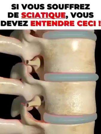 Non, ce n’est pas ta faute… Les solutions classiques ne font que masquer la douleur. Celle-ci libère vraiment ton dos.