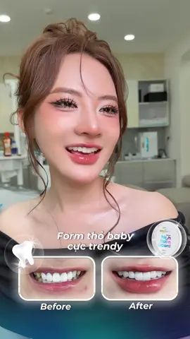 Sự thay đổi này quá xứng đáng đk cả nhà iuuu 🤍 #HanDental #Nhakhoahotgirl 