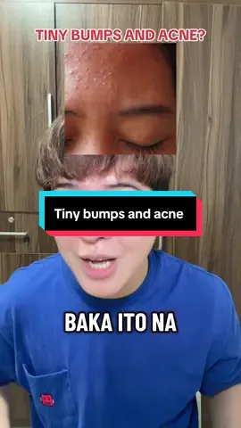 Tiny bumps and acne  #fyp #tinybumps #acne #cleanserfortinybumps 