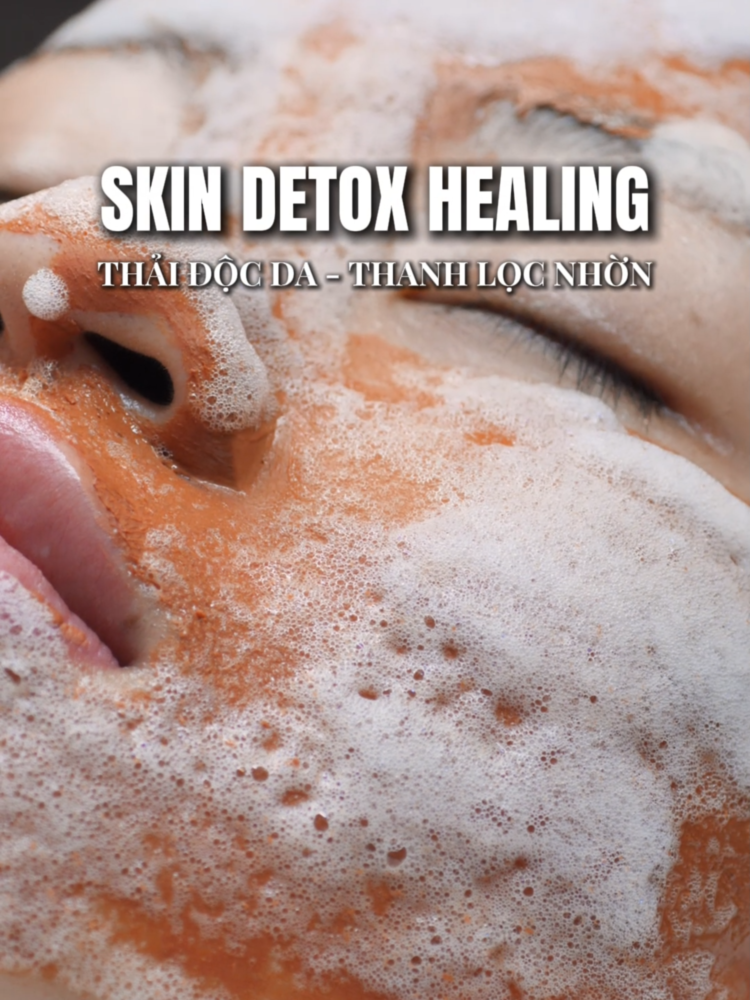 SKIN DETOX HEALING: thải độc da - thanh lọc nhờn! #mialalanhatrang #spanhatrang #detoxda #lamsachsau #xh
