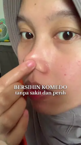 Nyesel bgt gk beli dari lama,udah nyoba ini itu yg paling gong cuma ini @FOCALSKIN Indonesia #fyppppppppppppppppppppppp #pencabutkomedo #blackheadrem #focalskincare #pembersihkomedo 