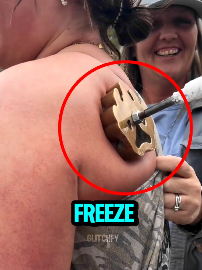 Freeze Branding Tattoo? Don’t Try This! 😨 This girl is getting a freeze branding tattoo—and it’s going viral all over social media. But what people don’t realize is how risky this actually is. While it's sometimes done safely on animals, doing it on human skin can be seriously dangerous. It can cause deep scars, hyperpigmentation, and permanent damage. So yeah… this may look cool, but don’t even think about trying it yourself. #branding #tattoo #freeze #fyp #foryou 