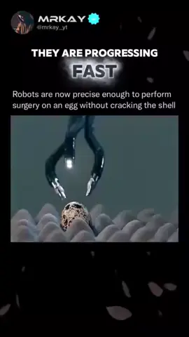 Surgery  #surgeon #surgery #professional #robotics #futuretech 