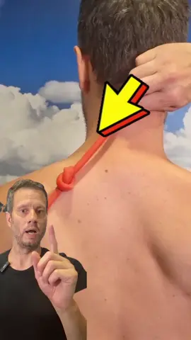 💥 Bol u vratu i ramenima? Često je krivac triger tačka u trapezijusu. 👉 To je mali zategnuti čvor u mišiću koji može da izazove lokalni bol, ali i da šalje bol u glavu, potiljak ili lopaticu. 📌 Pacijenti ga opisuju kao „čvor“ ili „kamenčić“ u mišiću koji boli na pritisak. Najčešći uzroci: dugotrajno sedenje za računarom 🖥️ stres 😰 loše držanje 🪑 nedostatak kretanja 🚶 Dobra vest je da se bol može smanjiti ciljanim tretmanima, istezanjem i pravilnim vežbama. 📞 Za više informacija ili zakazivanje termina: 0604244220