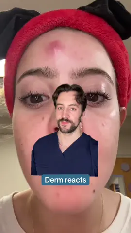 How to ACTUALLY help those whopper acne cysts! Here are some things that can make a difference. What has worked for you? Let me know in the comments ⬇️ Original vid: @cheeto🙈  #cysticacne #acnetreatment #dermarkologist #dermatologist #skincaretips