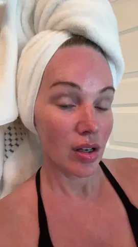 #ad this stuff is absolutely incredible. I no longer have hollow under eyes, I plump my lips, my face and my hands #koreanskincare #koreanskincareproducts #skincareroutine #skincaretips 